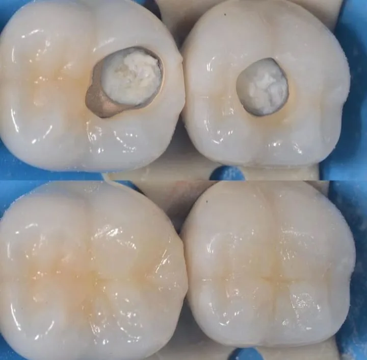 Alanya HEALTHY TEETH Dental Aesthetic — Medicina em Alanya: Encomenda online, preços e comentários